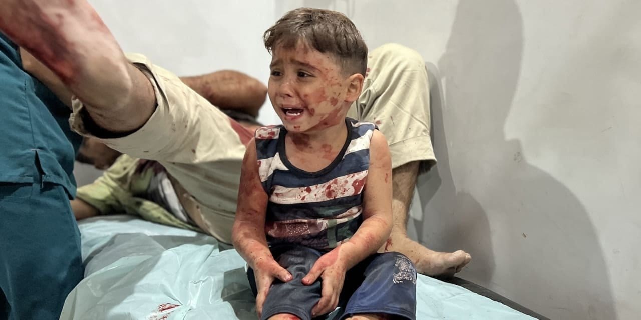 israilin abluka uyguladigi gazze seridinde acliktan olenlerin sayisi artiyor cbnxShCm